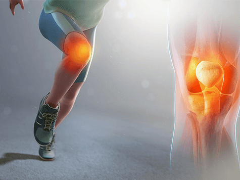 ¿Está cerca la cura de la artrosis de rodilla? 1 cura para la artrosis de rodilla