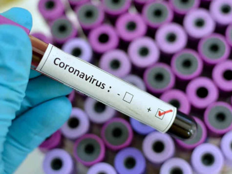 Israel se moviliza para encontrar soluciones al coronavirus