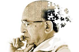 Estudio cerebral no invasivo para prevenir el Alzheimer 1 Estudio cerebral no invasivo para prevenir el Alzheimer
