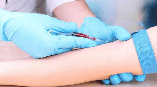 Un análisis de sangre desarrollado en Israel podría detectar cánceres pancreáticos y colorrectales 1 Un análisis de sangre desarrollado en Israel podría detectar cánceres pancreáticos y colorrectales